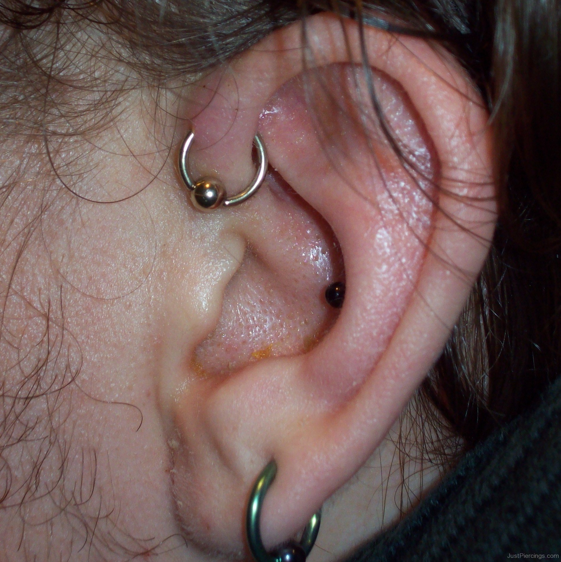 Anti Helix And Lobe Piercing With Ball Closure Ring