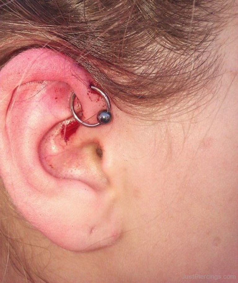 Anti Helix Piercing With Ball Closure Ring Image