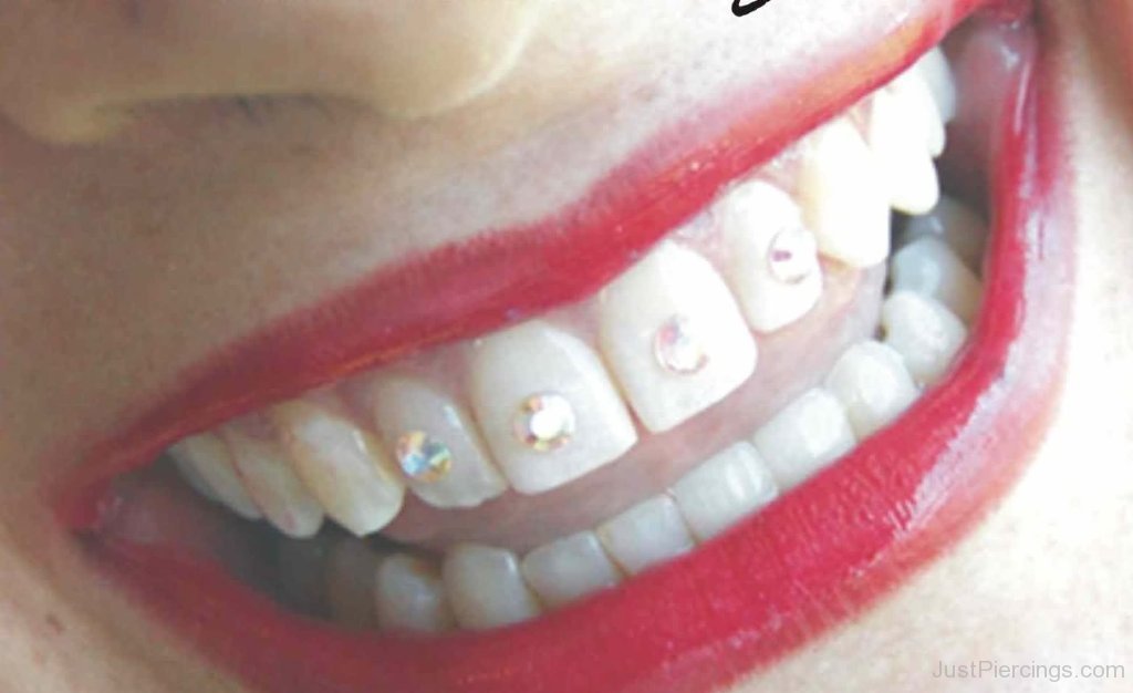 Tooth Piercings