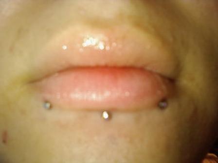 Combination Of Labret And Snakebites Piercing