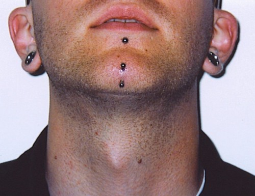 Multiple Chin and Ear Piercings