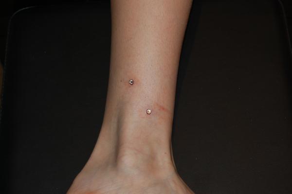 Piercing Picture of Ankle
