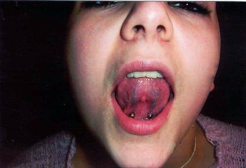 Girl Showing her Lingual Frenulum Piercing
