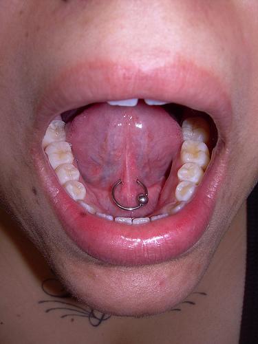 Lingual Frenulum Piercing Image