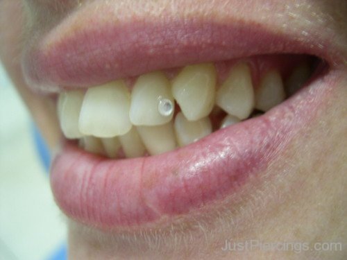 Dental Piercing 