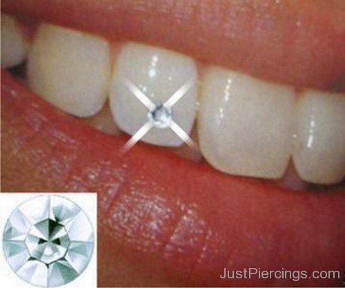 Dental Piercing