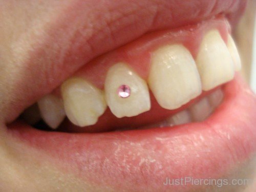 Dental Piercing Image