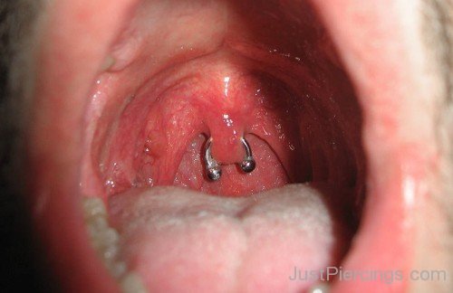 Uvula Piercing With Circular Barbell