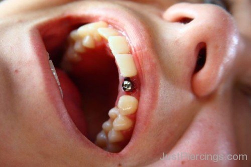 Gum Piercing Pic