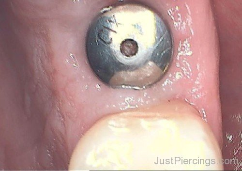 Gum Piercing Picture