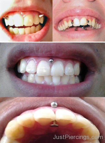 Gum Piercings Different Looks