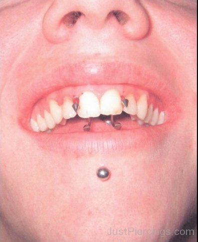 Gums And Labret Piercings