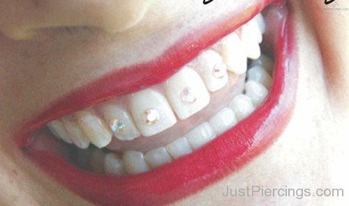 Jewel Tooth Piercings On All Teeths