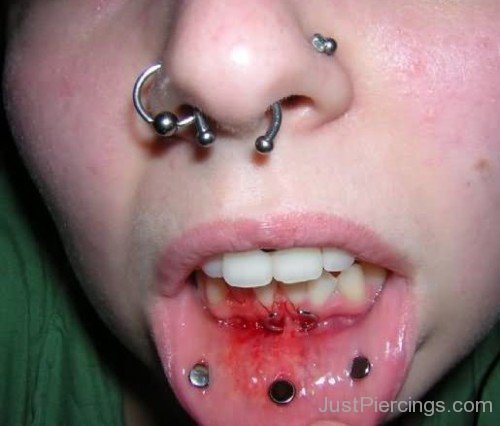 Multiple Nose Dermal Lips And Frowney Piercing