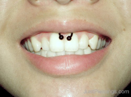 Smiley Piercing 
