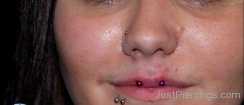 Surface Upper Lip,Nostril And  Shark Bites Piercings
