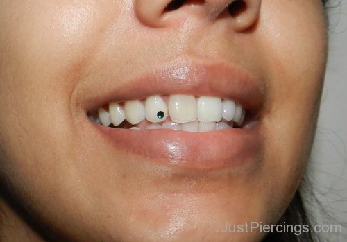 Tooth Gum Piercing For Young Girls