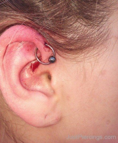 Ear Anti Helix Piercing With Ball Closure Ring