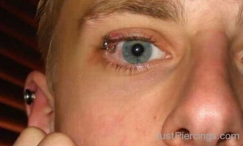 Eyelid And Orbital Piercing