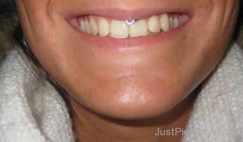 Smiley Lip Piercing With Lip Frenulum Piercing