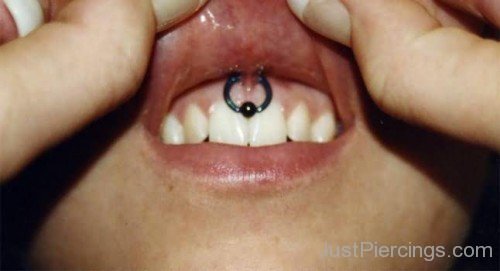 Smiley Upper Lip Frenulum Piercing