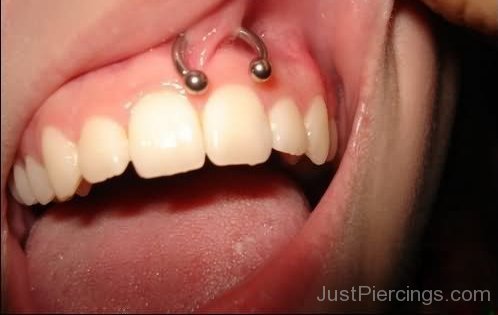 Gum Piercing-JP12312