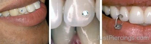 Gum Piercing On Teeths-JP12306