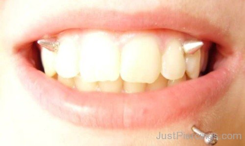 Lower Lip And Gum Piercing-JP12313