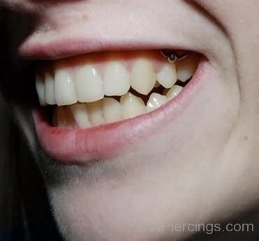 Single Gum Piercing For Girls-JP12315