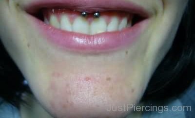 Smiley Gum Piercing-JP12316