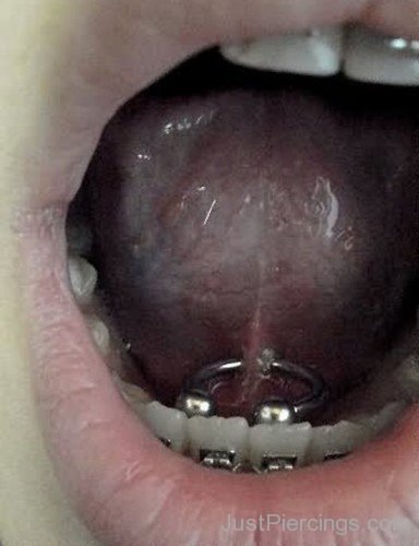 Circular Barbell Mouth Piercing-JP12306