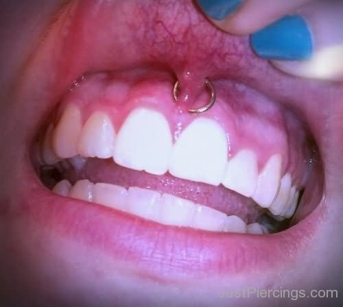 Mouth Frenulum Piercing With Gold Ring-JP12317