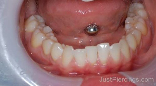 Mouth Piercing With Dermal-JP12328
