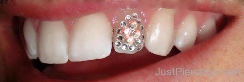 Beautiful Gem Stone Jewel Tooth Piercing