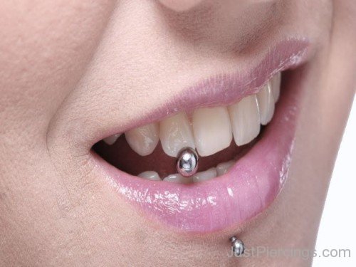 Dental Piercing