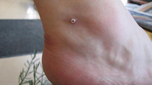 Dermal Anchoring Piercing On Ankle