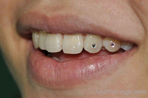 Jewel Tooth Piercing
