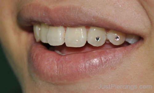 Jewel Tooth Piercings For Girl