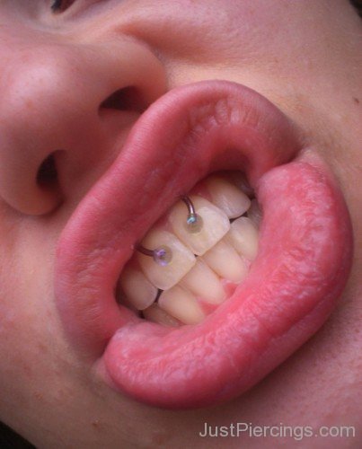 Gum Piercing