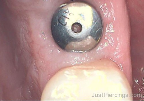 Gum Piercing Picture-JP407