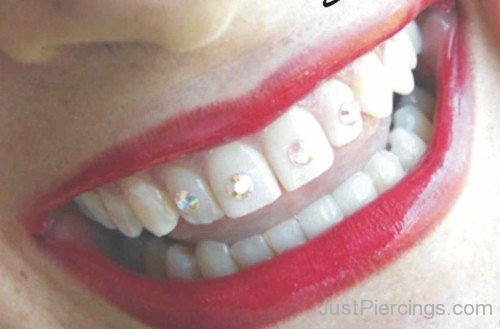 Jewel Tooth Piercing-JP412