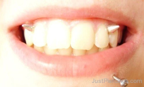 Lower Lip and Gum Piercing-JP418