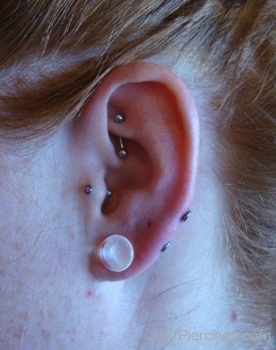 Transverse Lobe With A Surface Bar