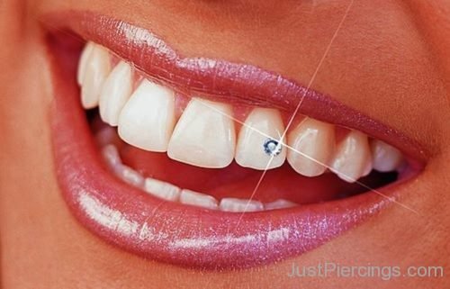 Awesome Teeth Piercing-JP102