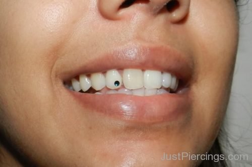 Blue-Tooth-Piercing-Image-JP109