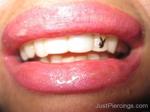 Dental Piercing Pic-JP111
