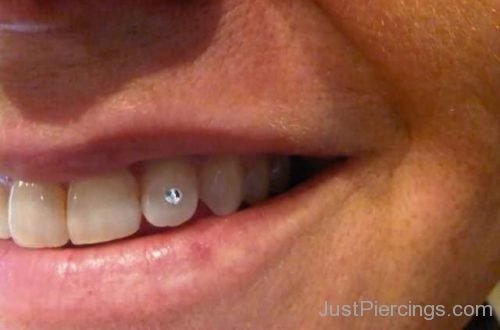 Diamond Jewel Tooth Piercing Closeup Image-JP113