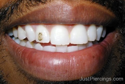 Gem Tooth Piercing-JP115