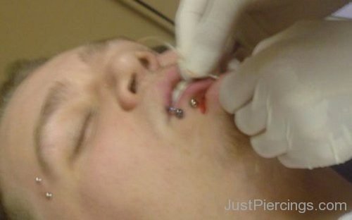 Surface Chin Piercing In Process-JP132