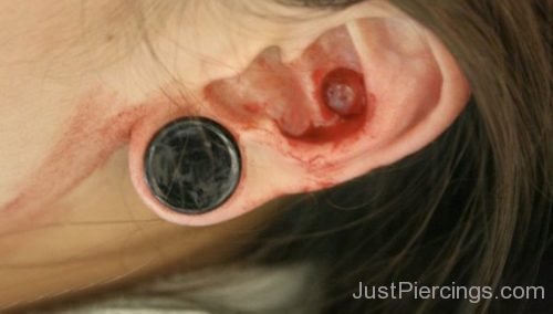 Conch Punch Piercing And Lobe Stretching-JP1079